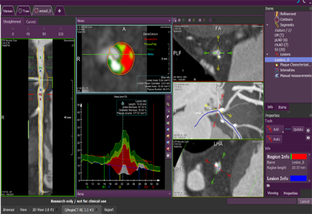 Medis Suite CT Research Apps