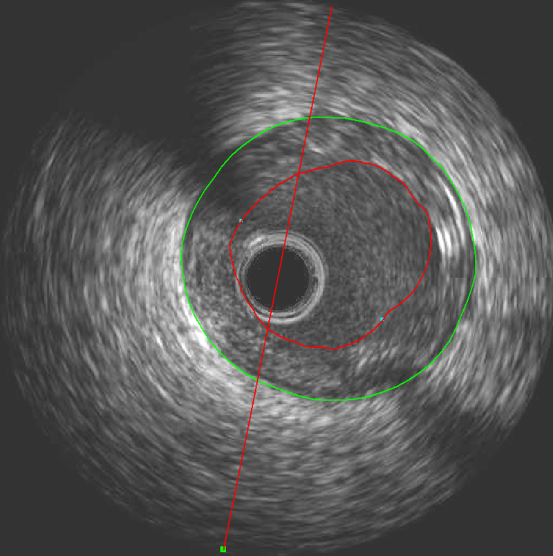 qivus medis medical imaging