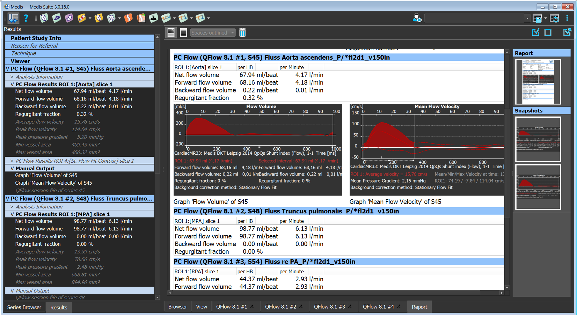 report_multiple_flows