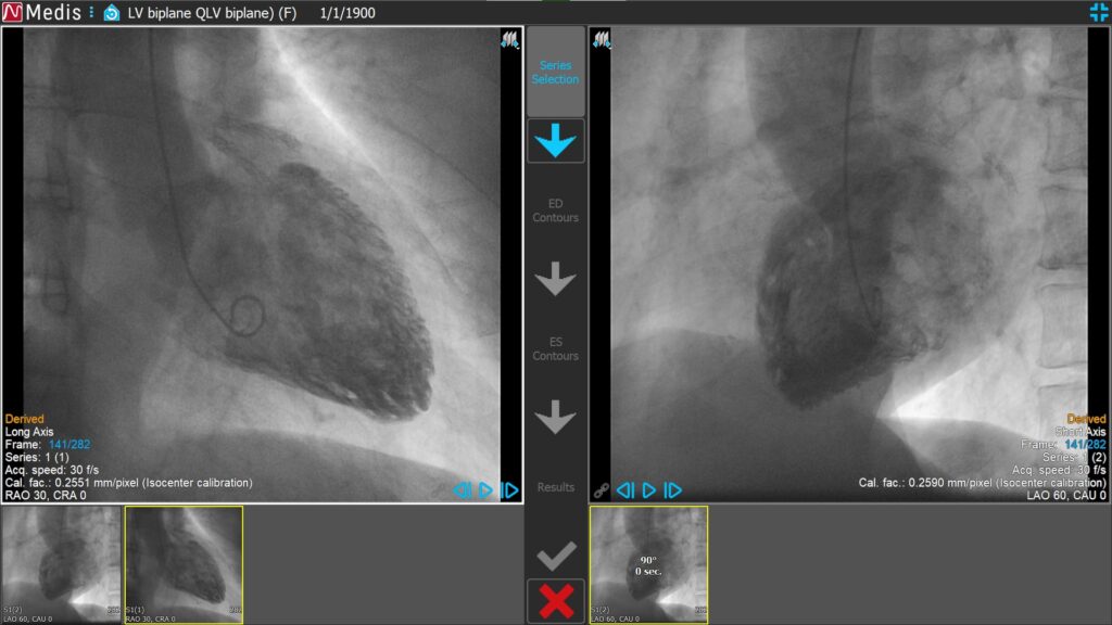 Medis Suite XA LV Biplane 1 Series Selection QLV Biplane
