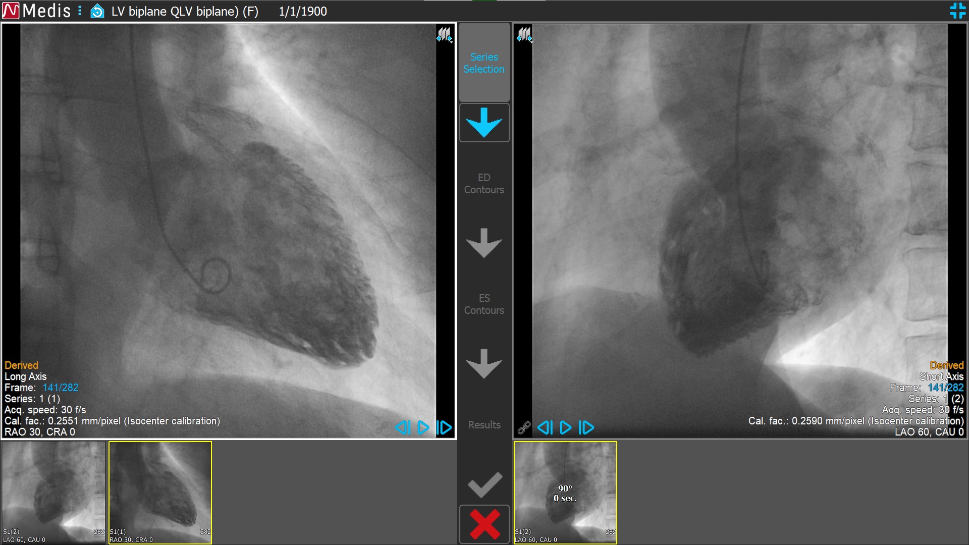 Medis Suite XA LV Biplane 1 Series Selection QLV Biplane