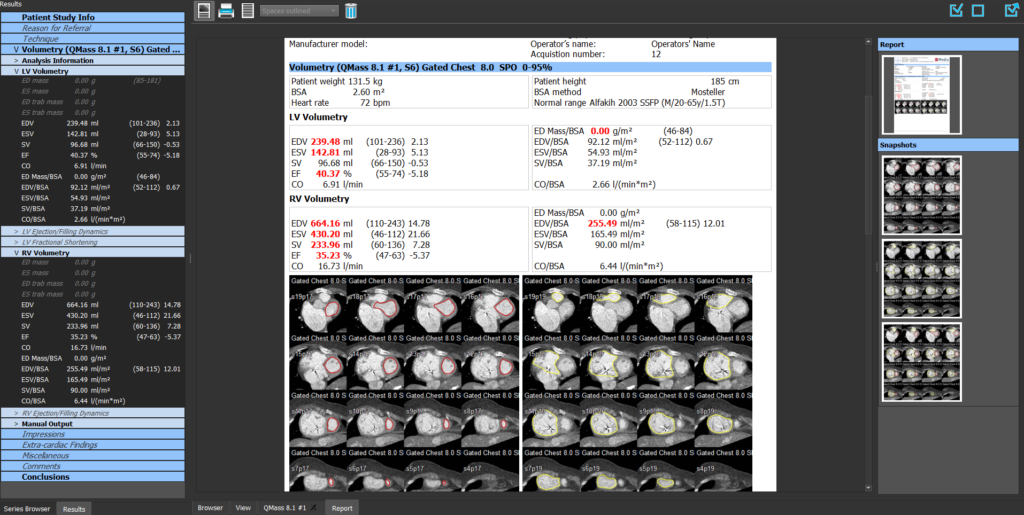 Medis Suite CT – Report