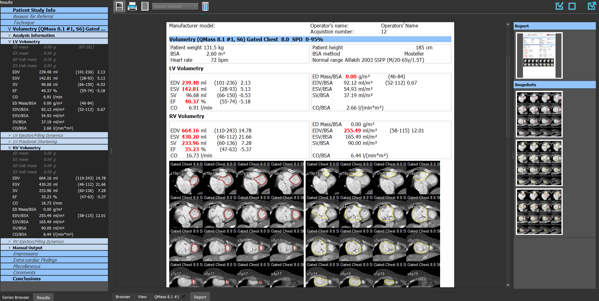 Medis Suite CT – Report