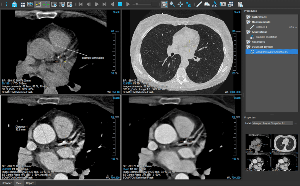 Medis Suite CT Viewer