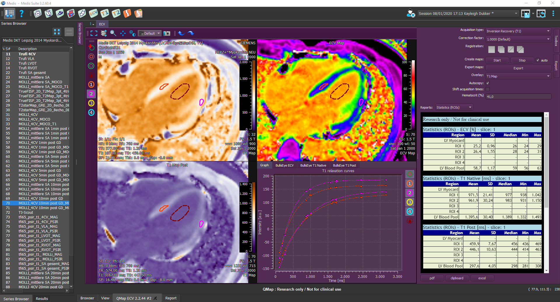 Extracellular Volume Module 2