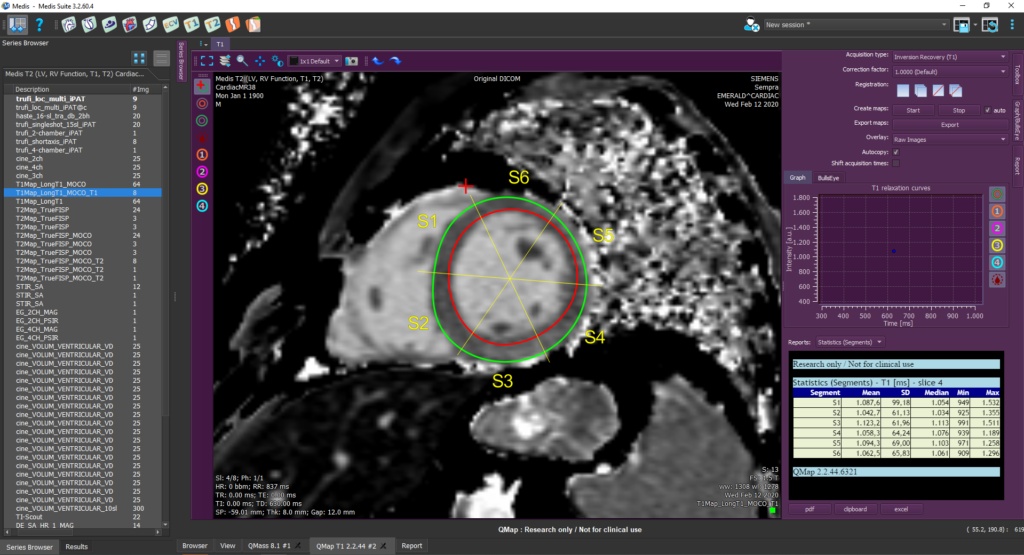 Medis Suite MR Research application T1 Mapping Module 3