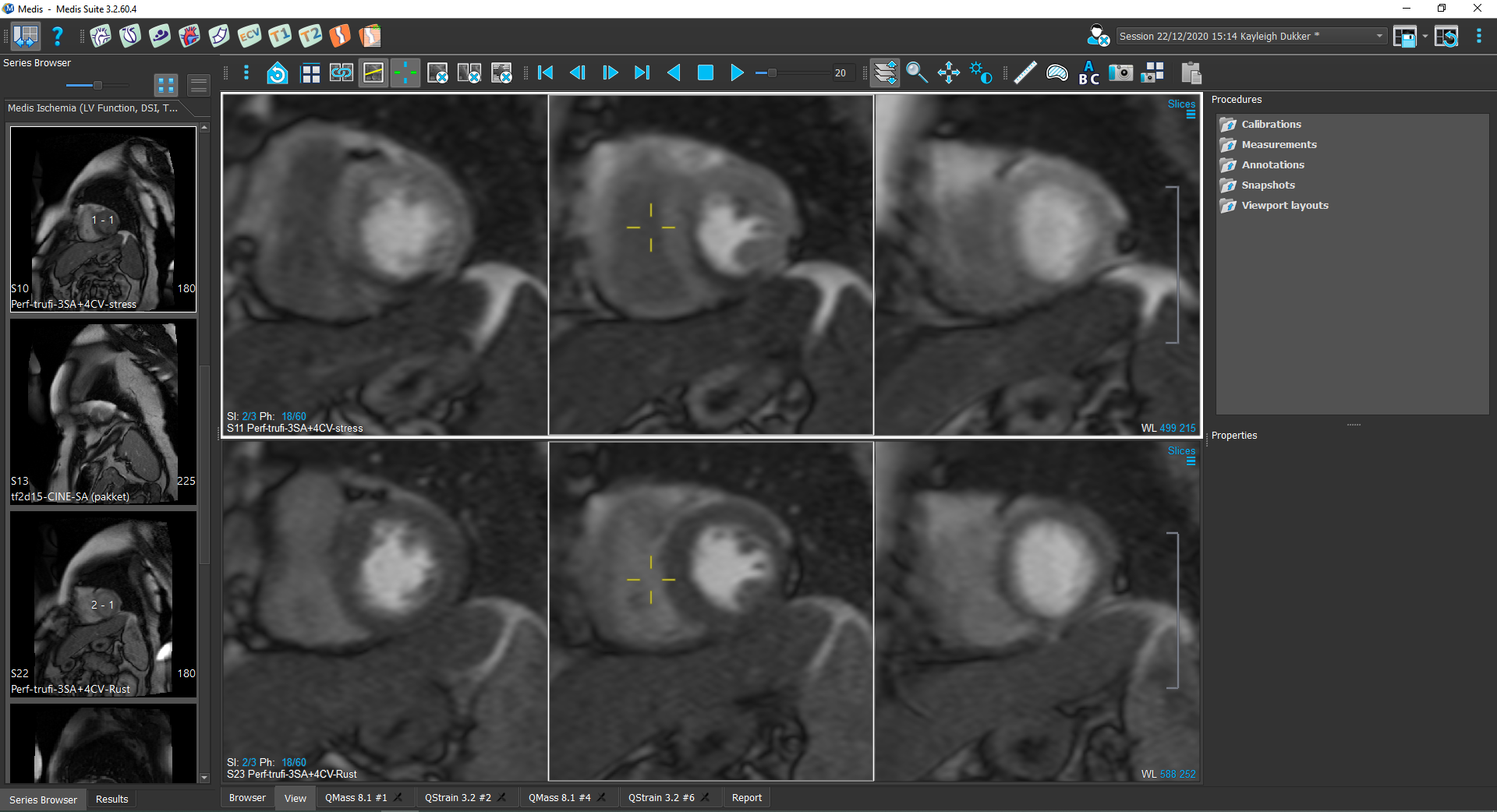 TimeSignalIntensity_Module1