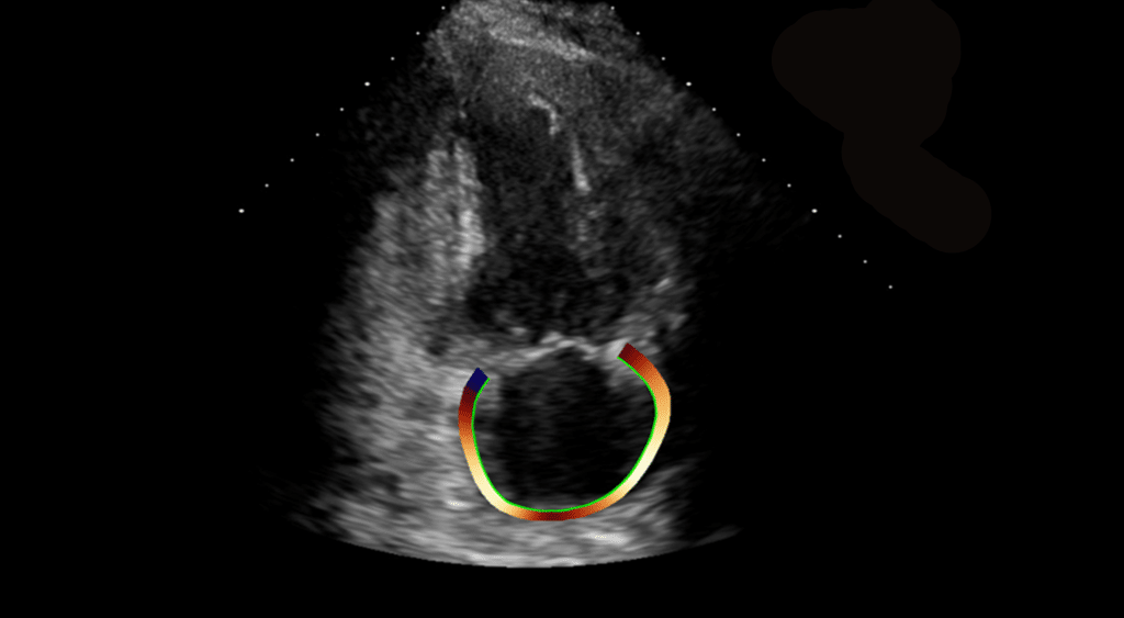 US LA Strain image for website