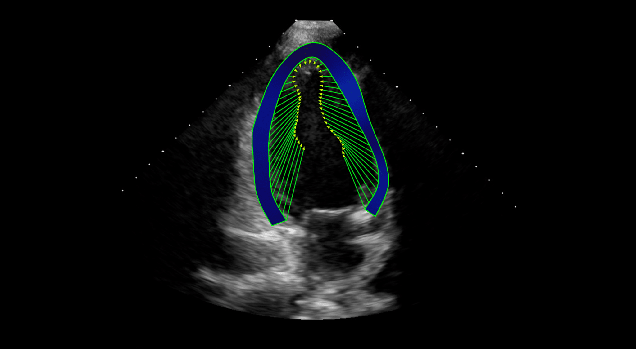 US LV Strain image for website