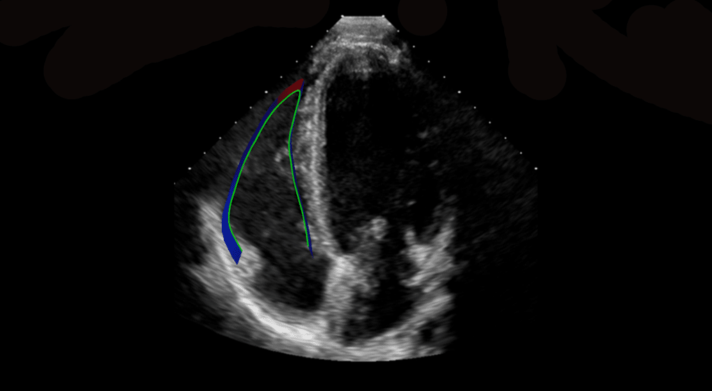 US RV Strain image for website