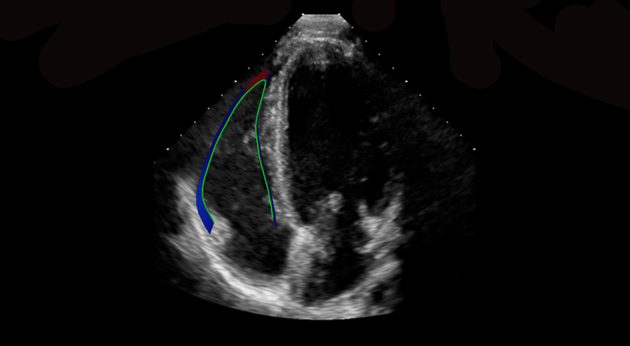US RV Strain image for website