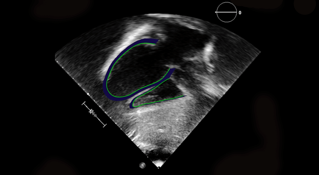 US Fetal Strain image for website