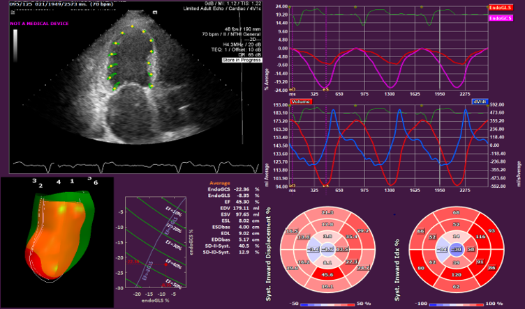 Inward Displacement image for website