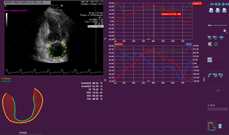 LA function image for website