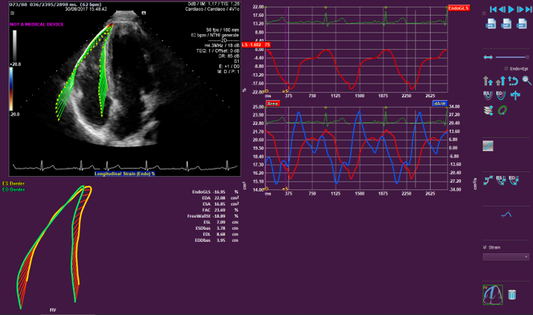 RV strain image for website