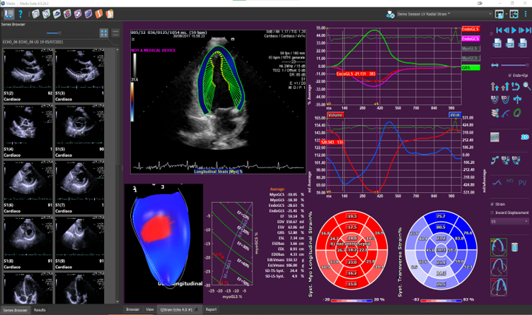 Echo image for website