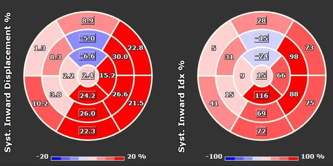 inward displaccement