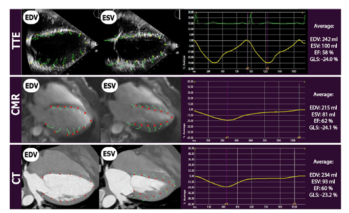 Strain image modalities