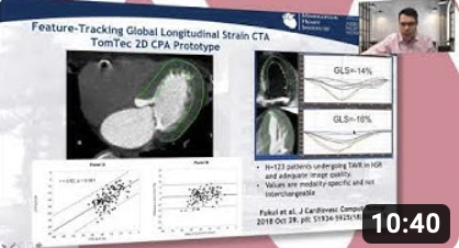 Dr. Joao Cavalcante on the use of CT in Strain research - EACVI
