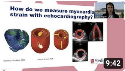 Dr. Victoria Delgado on the use of ECHO in Strain research - EACVI