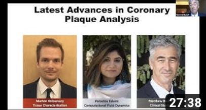 SCCT webinar December 2020: Latest advances in coronary plaque analysis