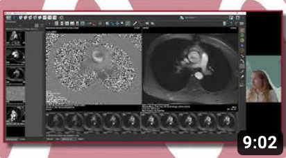 MR Explained: 2D Flow
