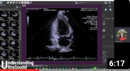 Understanding Ultrasound #1 Strain