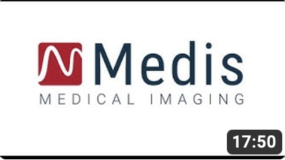 What's new Webinar XA