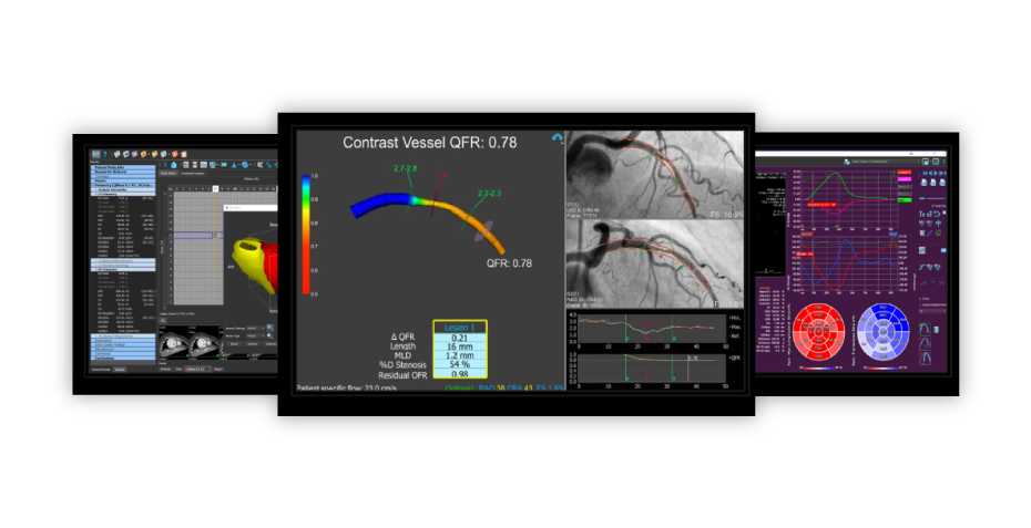 An image of the software solutions of medis