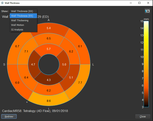 Tips n tricks 2nd edition