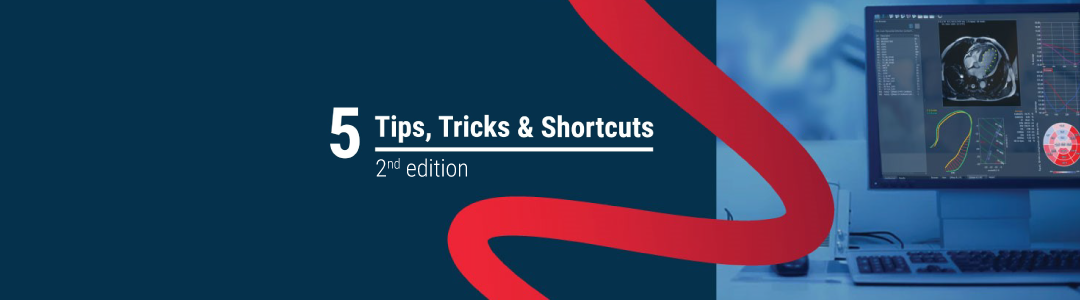 Tips, Tricks & Shortcuts: 2nd edition