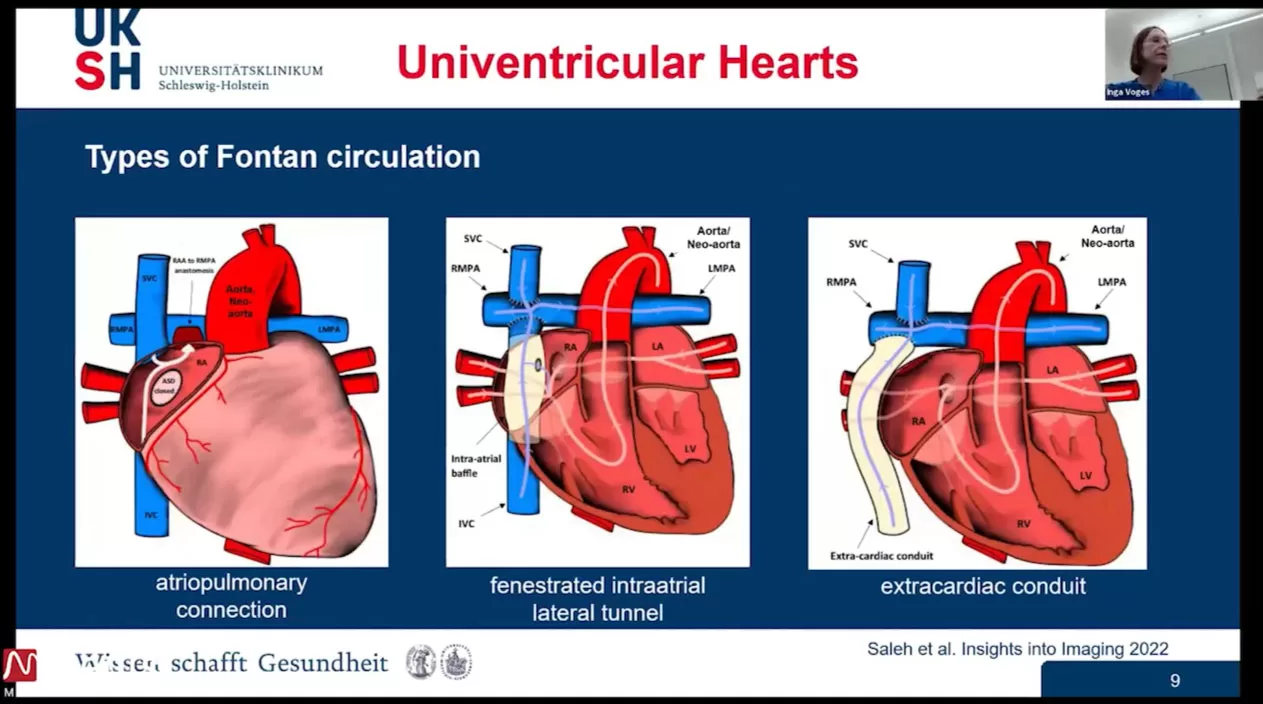 Webinar MR measuring volume