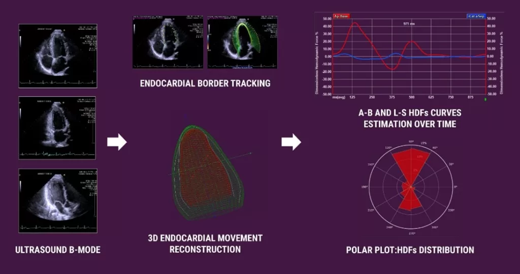 Systematic Overview ultrasound Hemodynamic Forces HDF.