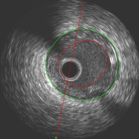 qivus medis medical imaging